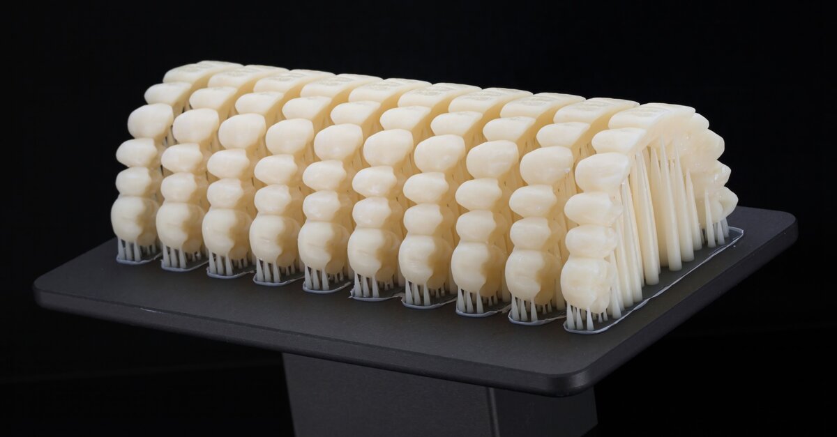 Intelligenza artificiale e stampa 3D: il futuro dell'odontoiatria etica