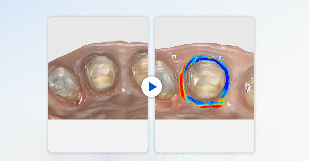 Nuova tecnologia Medit: scansioni dentali in tempo reale