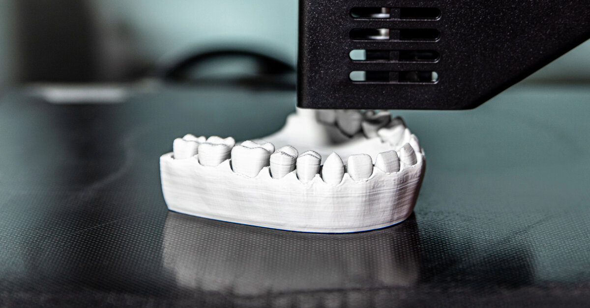 Stampa 3D in odontoiatria: protesi definitive sempre più vicine